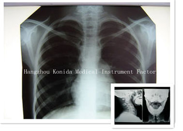 Film radiographique de X Ray de Digital du film 14 x 17inch de représentation sèche médicale de santé