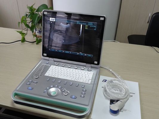 scanner portatif d'ultrason d'ordinateur portable de 3D Digital avec toutes sortes de sonde